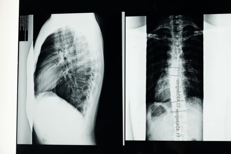 diagnosing pavatalgia disease guide